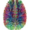 Mapa cerebral