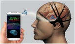 Detector de derrames cerebrais de Samsung