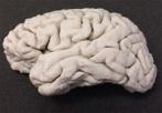 Cerebro impreso en 3D