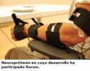 Neuroprótese